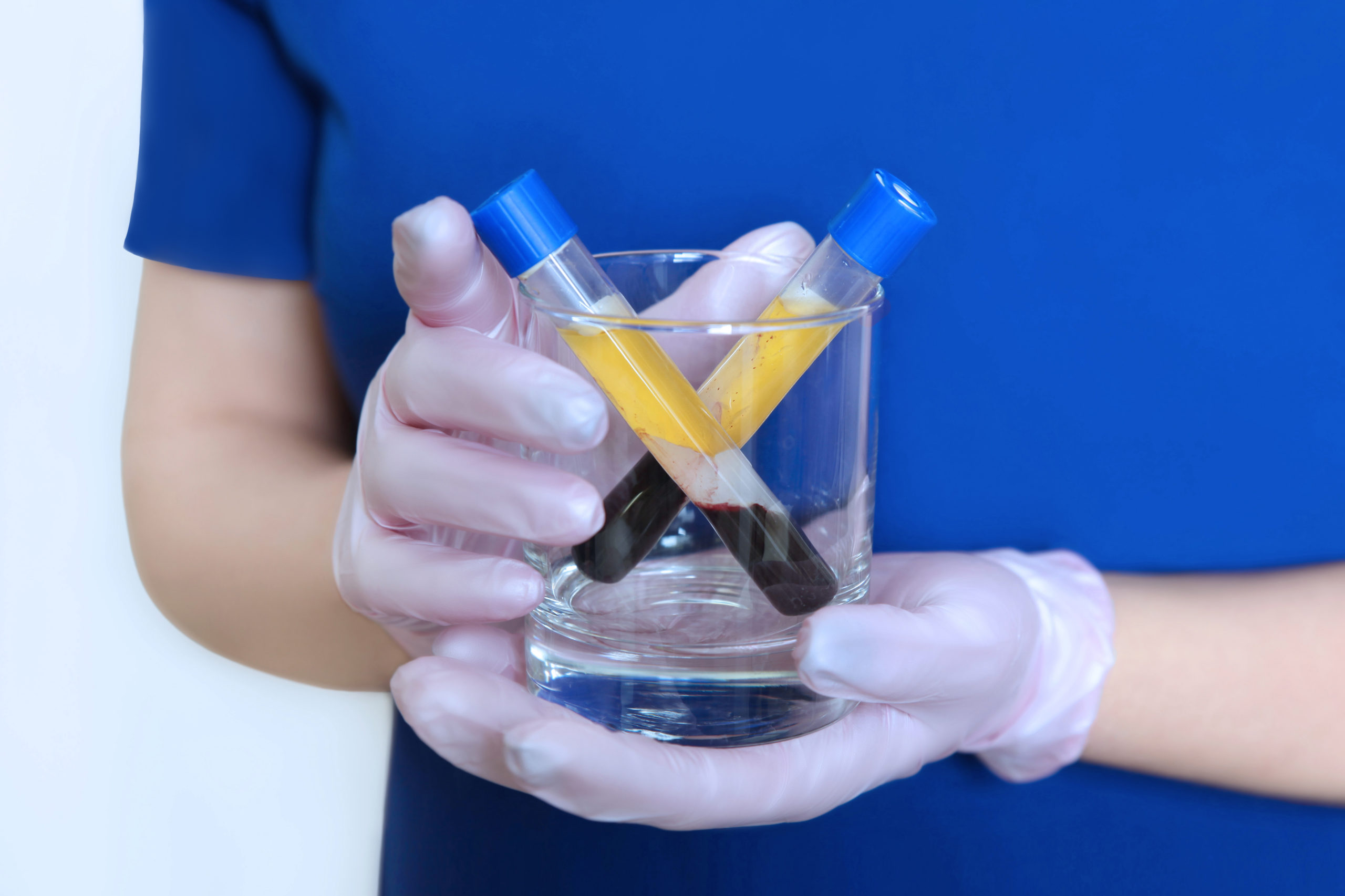 Platelet-Rich Plasma (PRP) Therapy